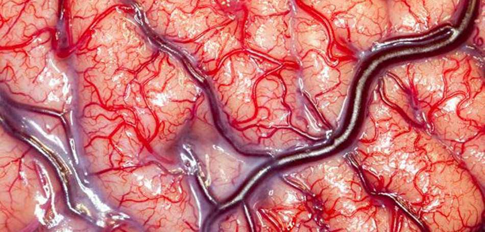 Atlas de Neuroanatomia Funcional Gratuito
