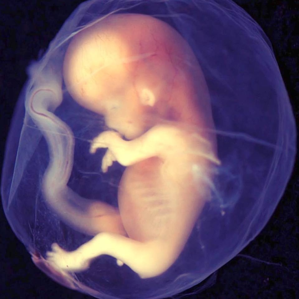 Aborto - No fundo a questão é sobre quem podemos matar
