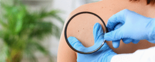Sociedade Brasileira de Dermatologia lança guia sobre COVID-19 e lesões de pele