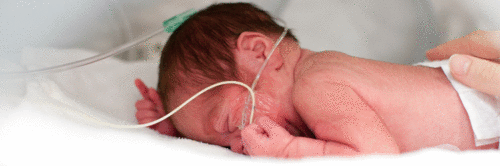 Pré-eclâmpsia e complicações perinatais aumentam risco de distúrbios do neurodesenvolvimento nos bebês