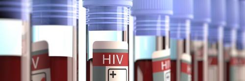 Grande número de usuários abandona profilaxia pré-exposição ao vírus HIV